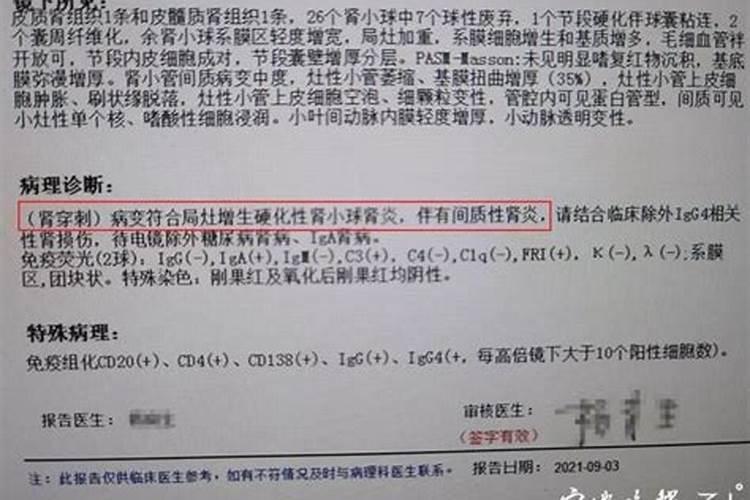 男人运气不好佩戴什么东西好