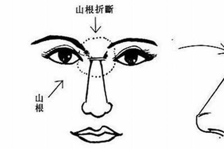 动了山根会影响运势吗