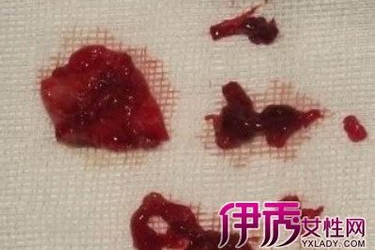 梦见爸爸大腿上流了很多血怎么回事