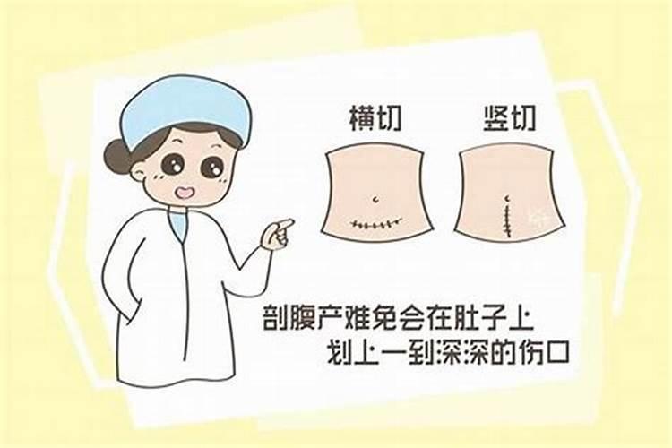 剖腹产一定要看日子吗