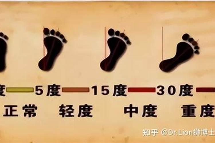 走路外八字的男人命不好吗