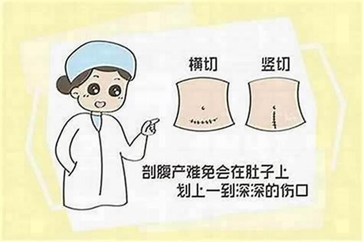 剖腹产八字到底准不准