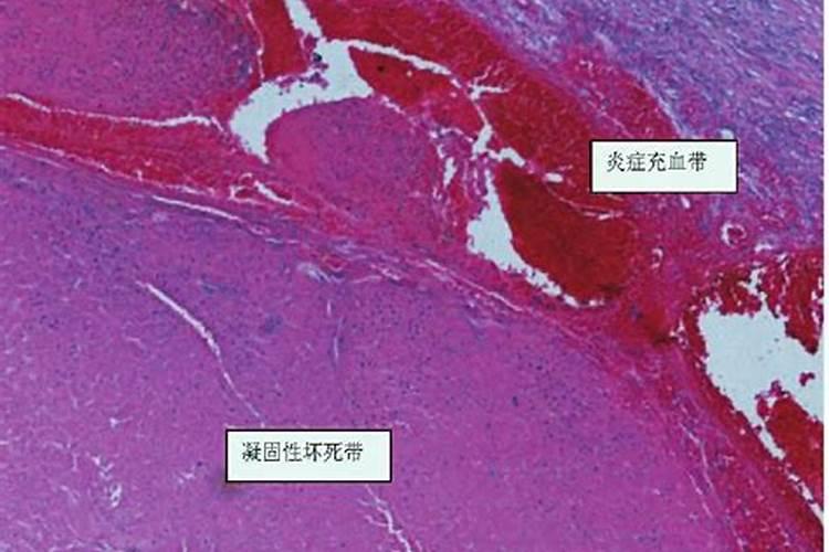 五行的病理表现