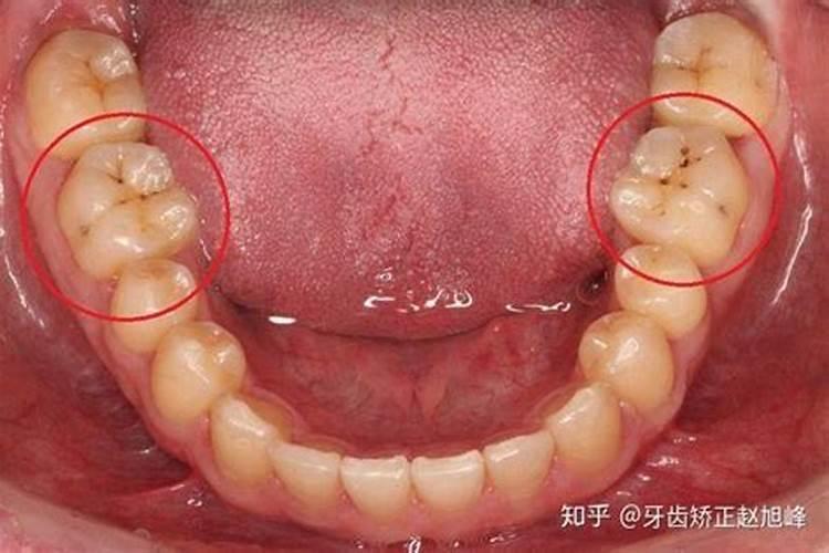 老梦见牙掉了怎么回事