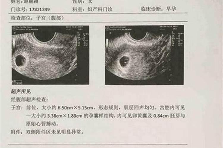 八字中合局的意义和作用