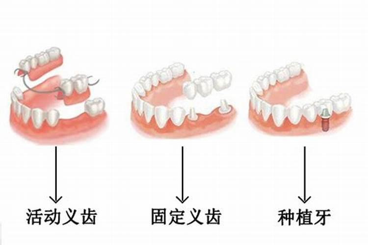 梦到儿子的牙掉了一颗